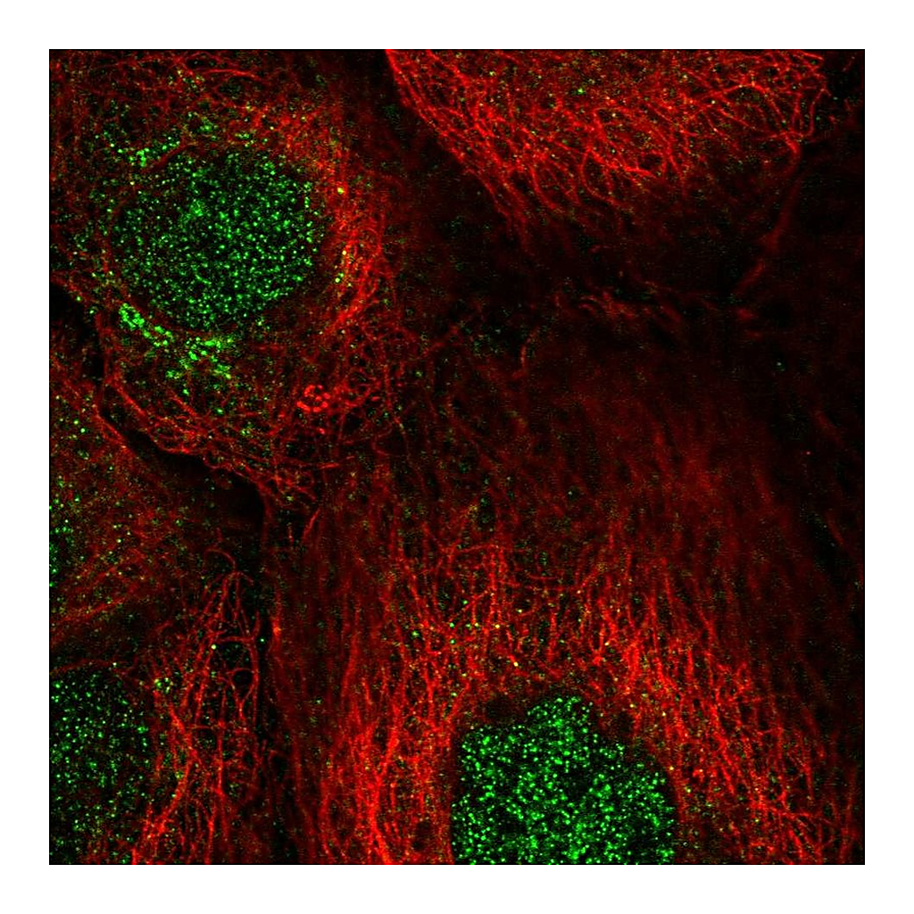 Atlas Antibodies Anti-CCNJ Antibody