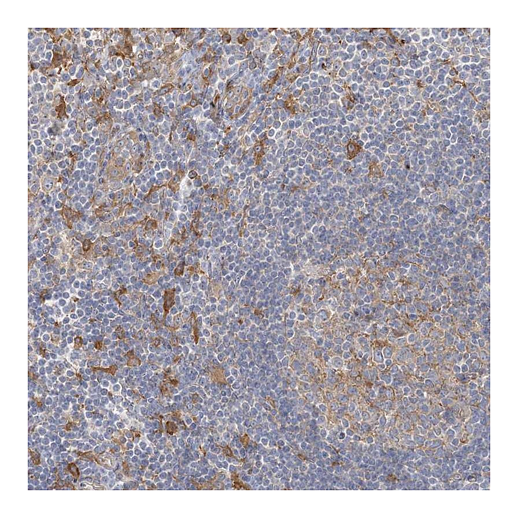 Atlas Antibodies Anti-CCNJ Antibody