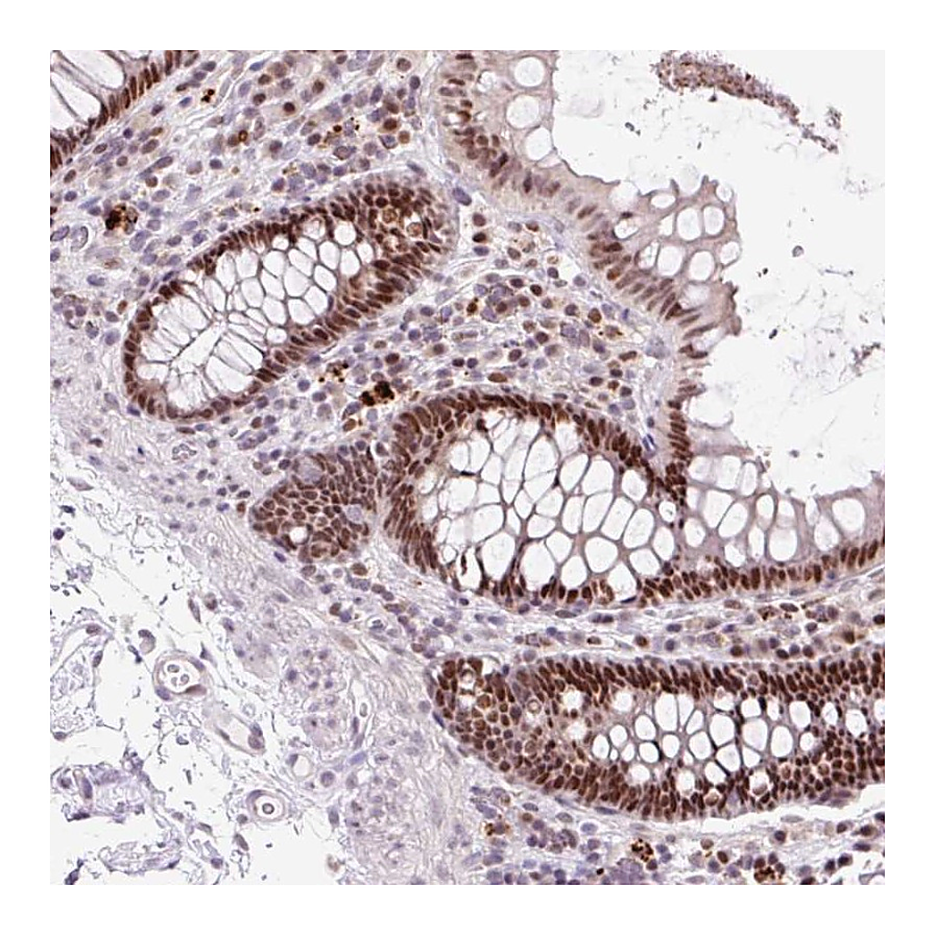 Atlas Antibodies Anti-CCNL2 Antibody