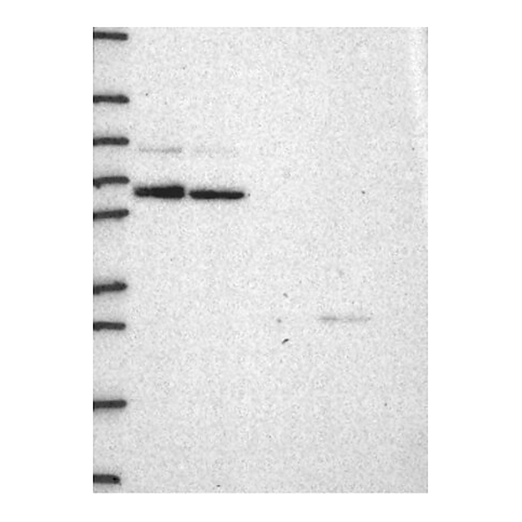 Atlas Antibodies Anti-CCNT1 Antibody