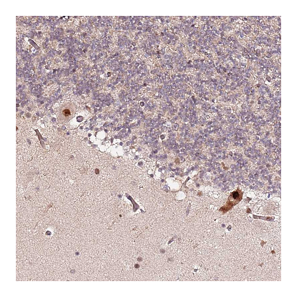 Atlas Antibodies Anti-CCNYL1 Antibody
