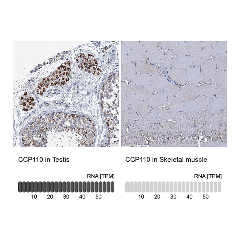 Atlas Antibodies Anti-CCP110 Antibody