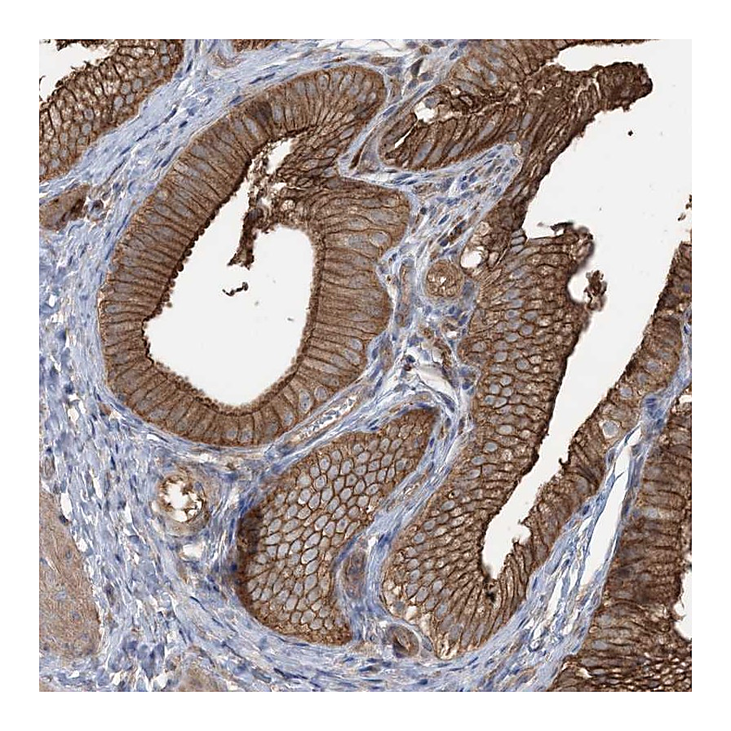 Atlas Antibodies Anti-CCNY Antibody