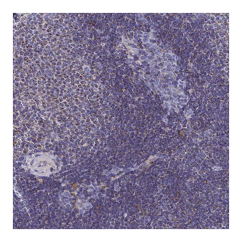 Atlas Antibodies Anti-CCRL2 Antibody
