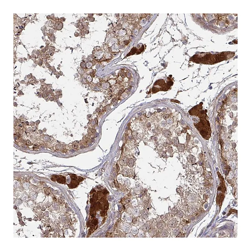 Atlas Antibodies Anti-CCS Antibody