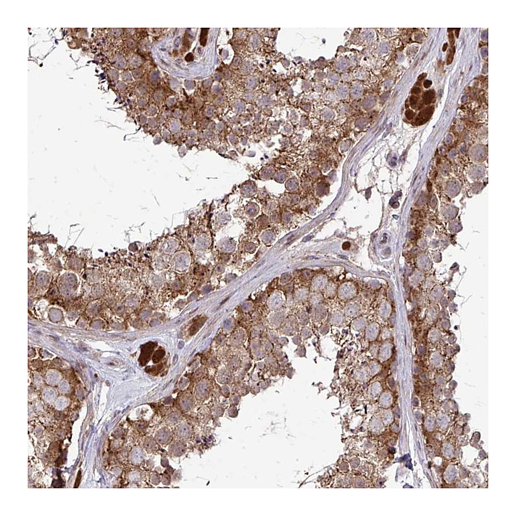 Atlas Antibodies Anti-CCS Antibody