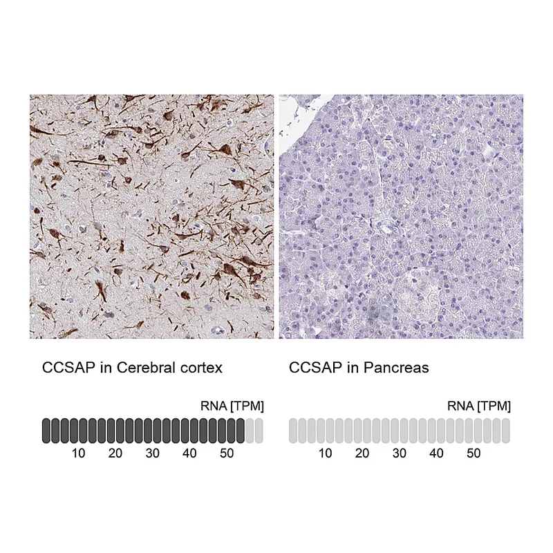 Atlas Antibodies Anti-CCSAP Antibody