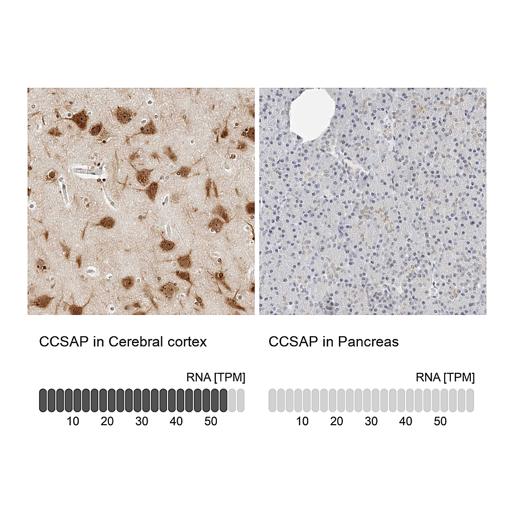 Atlas Antibodies Anti-CCSAP Antibody