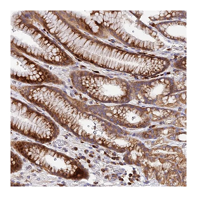 Atlas Antibodies Anti-CCT6A Antibody