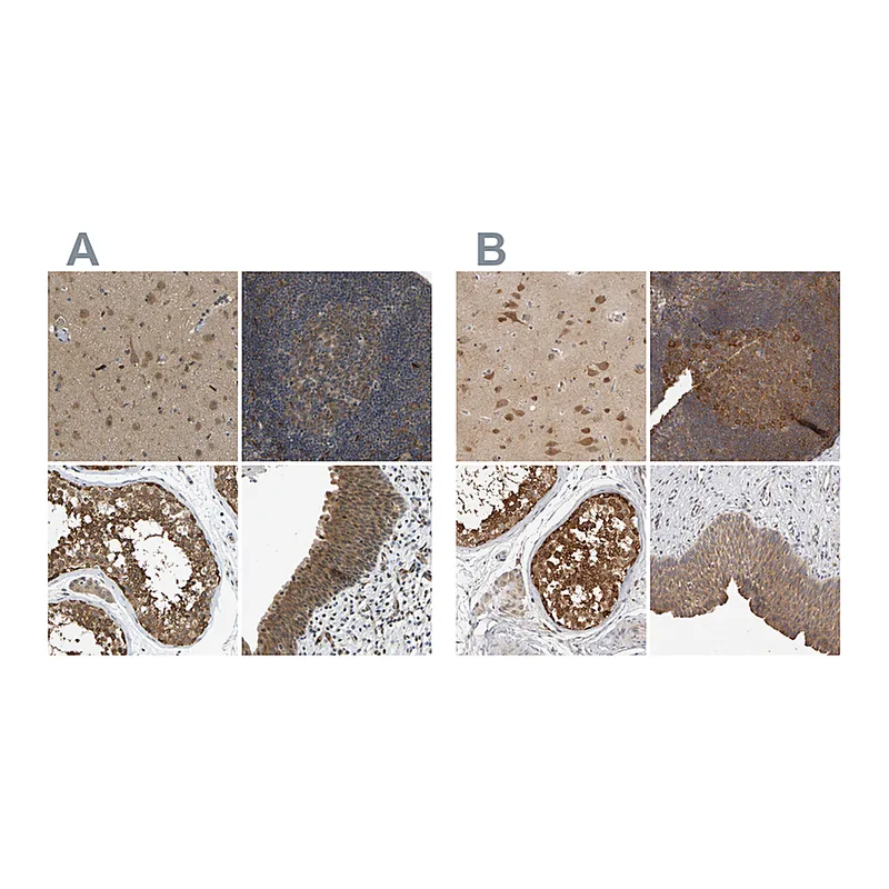 Atlas Antibodies Anti-CCT8 Antibody