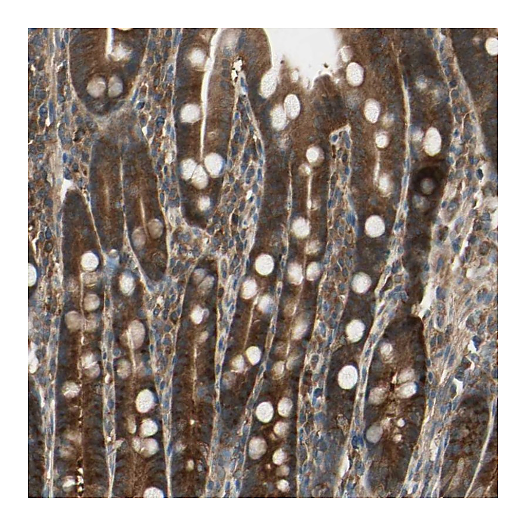 Atlas Antibodies Anti-CCT7 Antibody