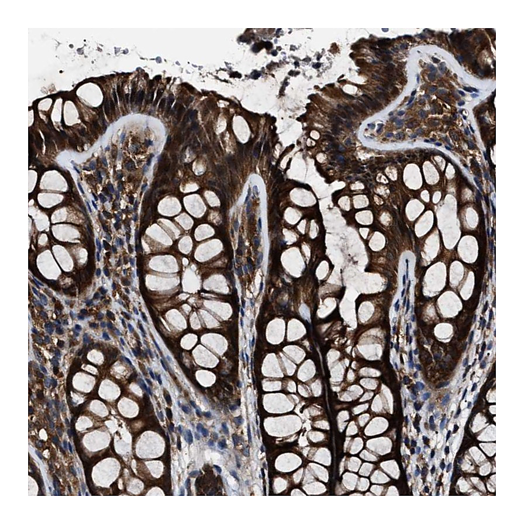 Atlas Antibodies Anti-CCT8 Antibody
