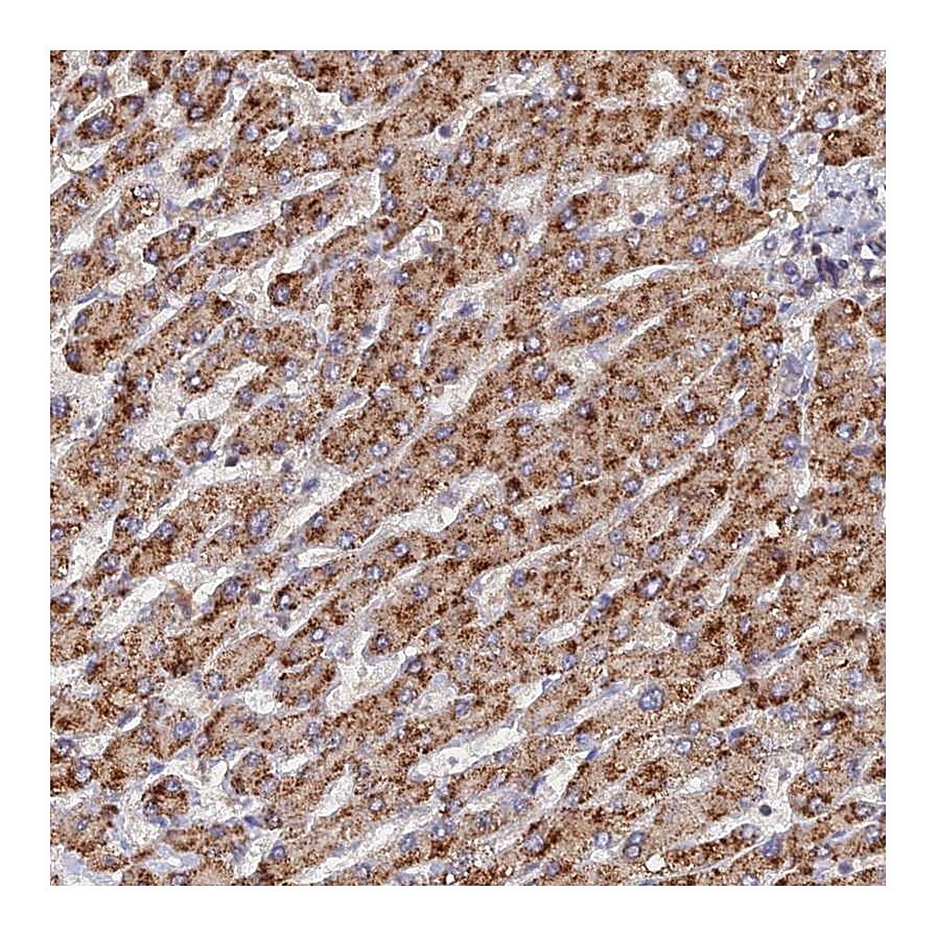 Atlas Antibodies Anti-CCZ1 Antibody