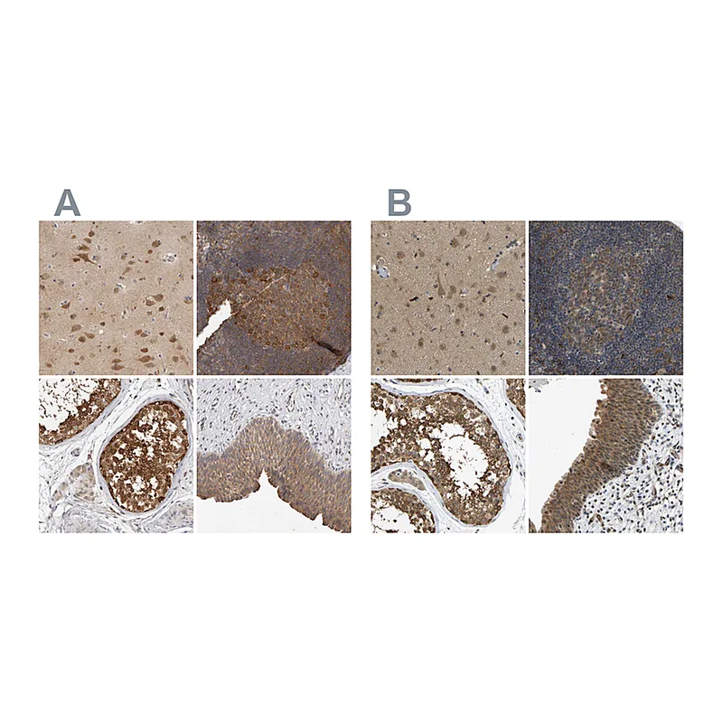 Atlas Antibodies Anti-CCT8 Antibody