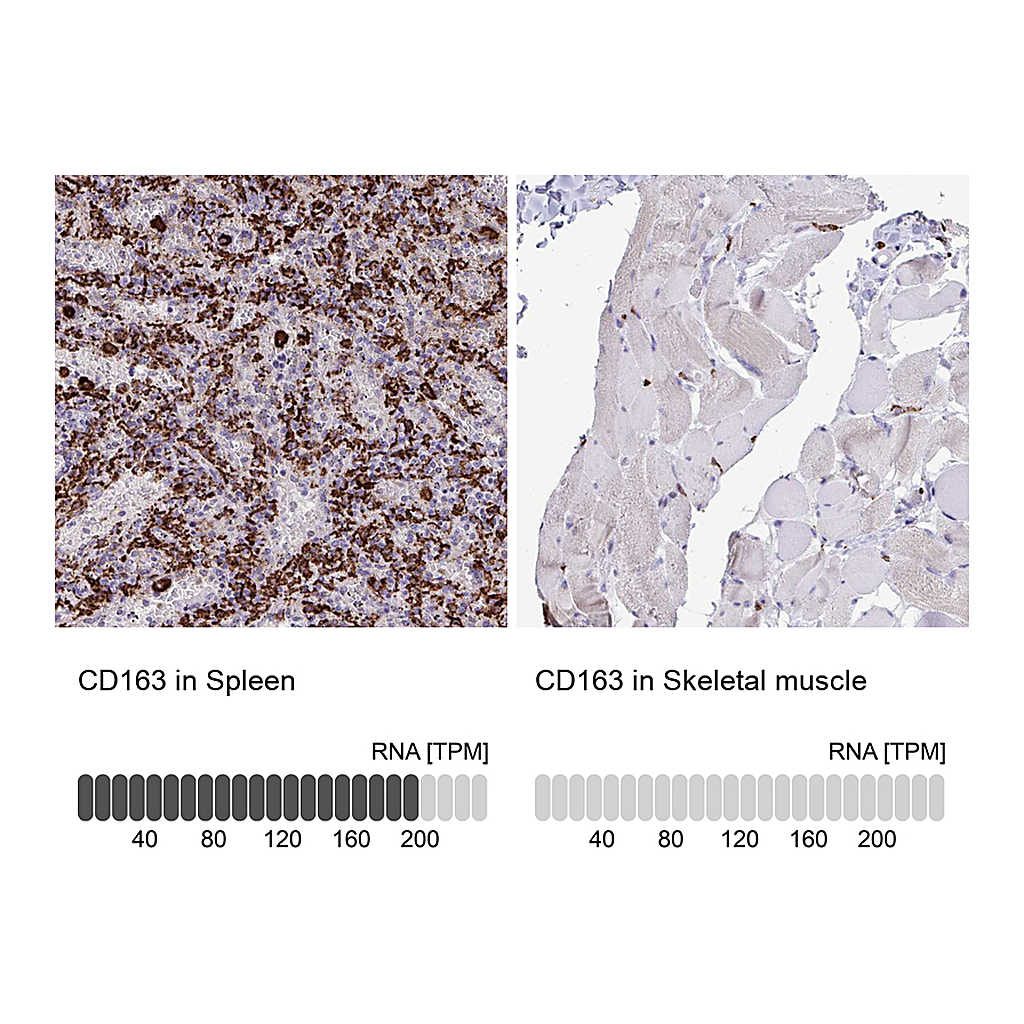 Atlas Antibodies Anti-CD163 Antibody