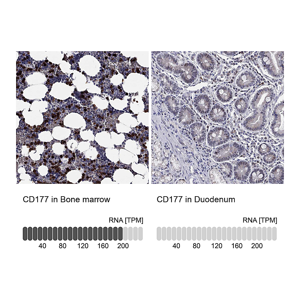 Atlas Antibodies Anti-CD177 Antibody
