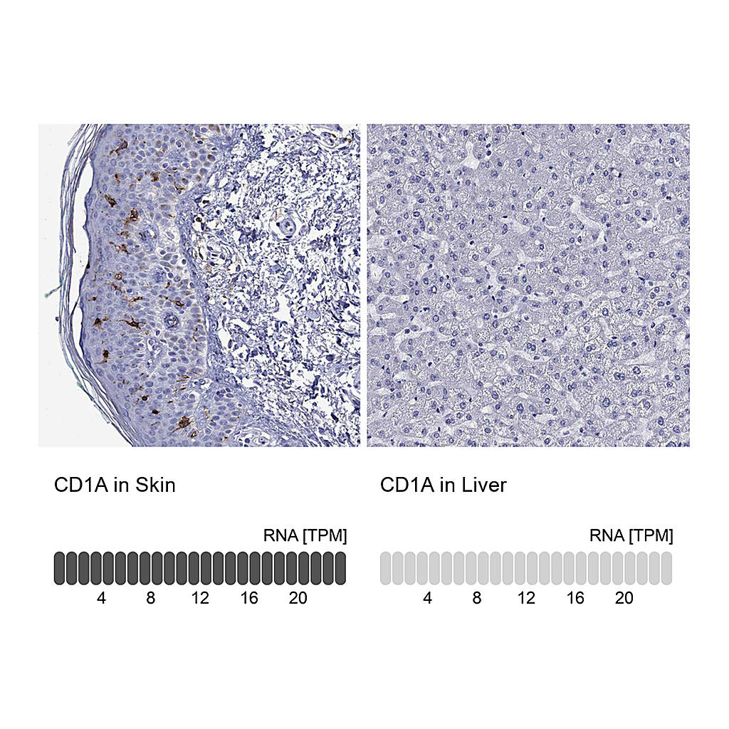 Atlas Antibodies Anti-CD1A Antibody