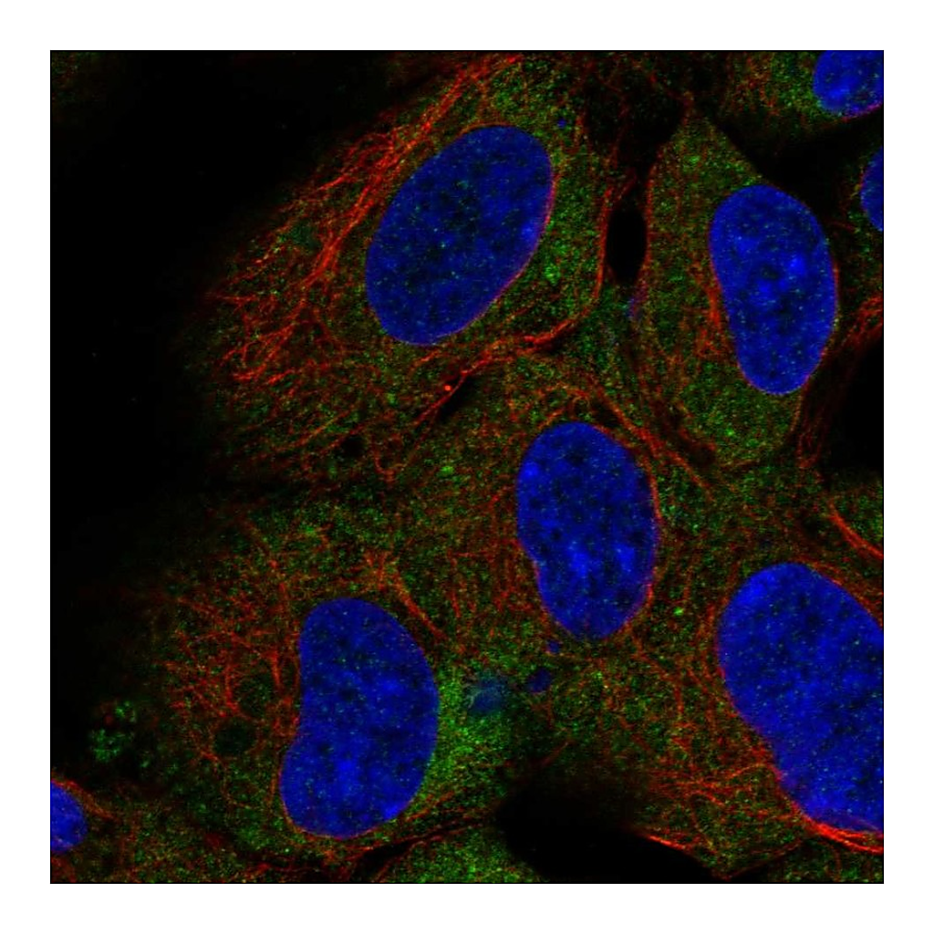 Atlas Antibodies Anti-CD1D Antibody