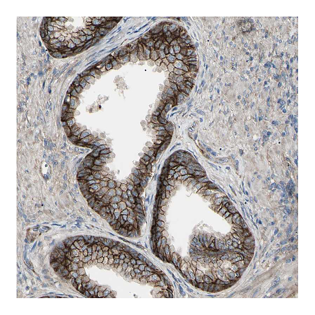 Atlas Antibodies Anti-CD276 Antibody