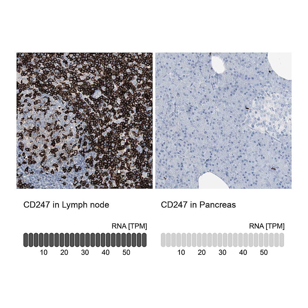 Atlas Antibodies Anti-CD247 Antibody
