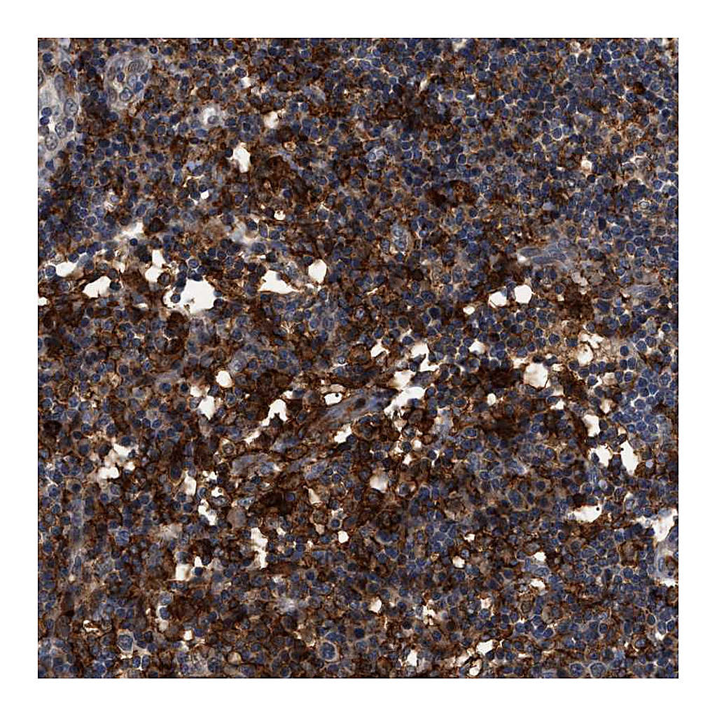 Atlas Antibodies Anti-CD300A Antibody