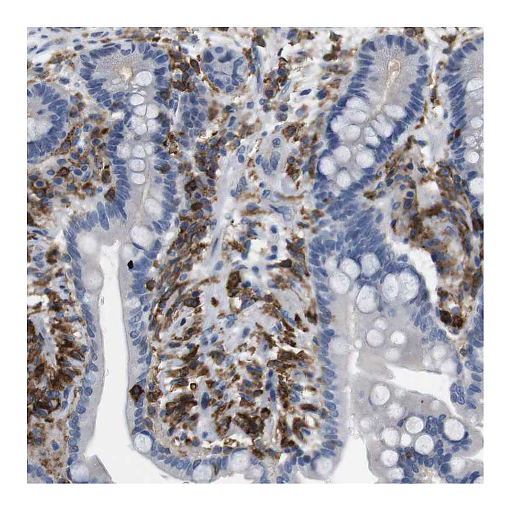 Atlas Antibodies Anti-CD300C Antibody