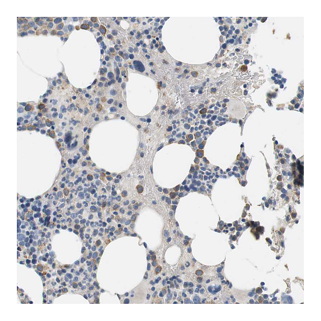 Atlas Antibodies Anti-CD300E Antibody