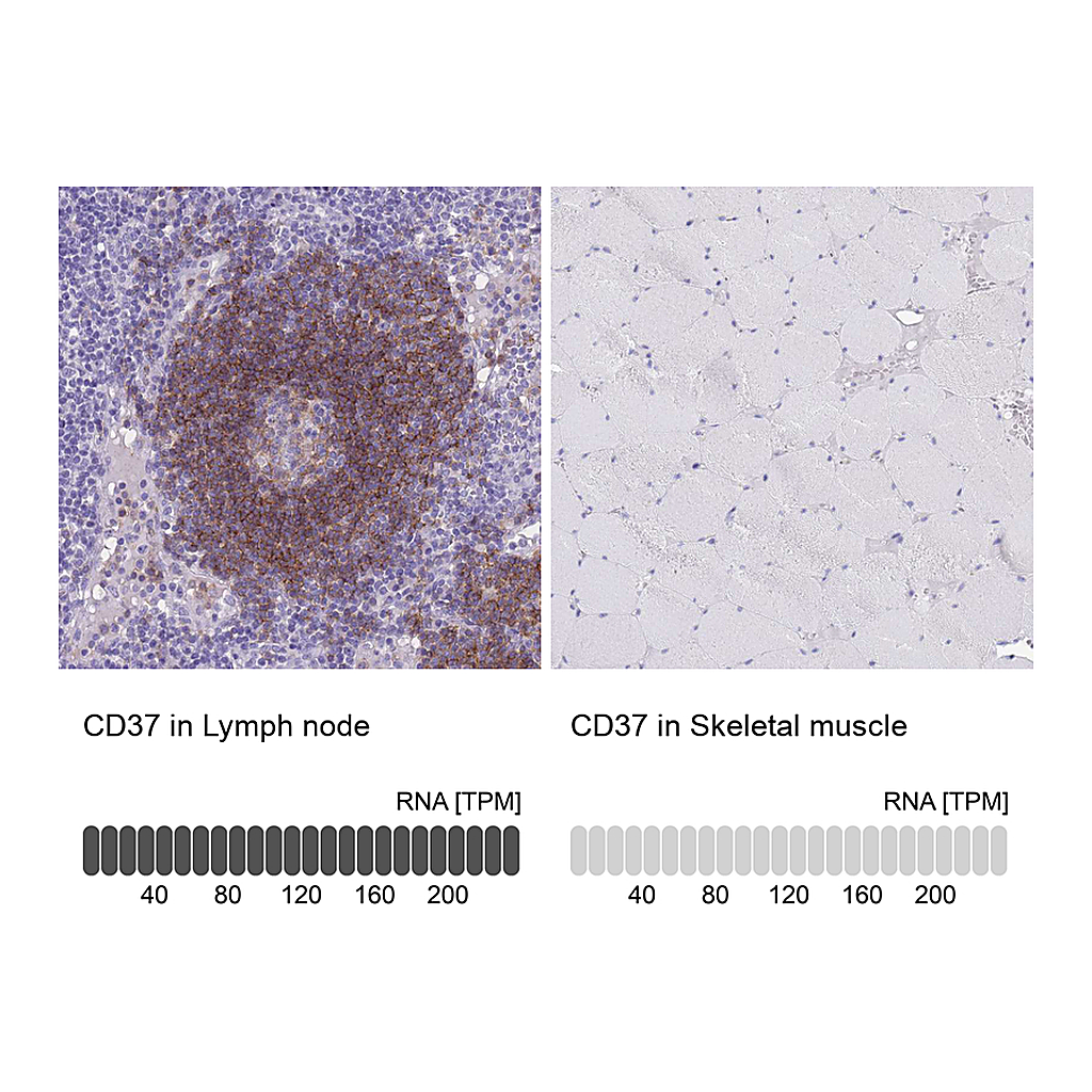 Atlas Antibodies Anti-CD37 Antibody