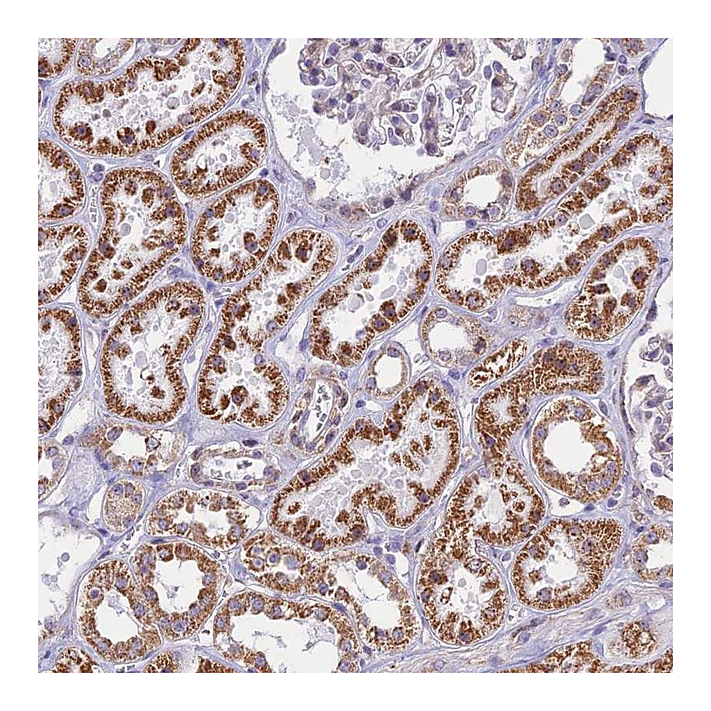 Atlas Antibodies Anti-CD3EAP Antibody