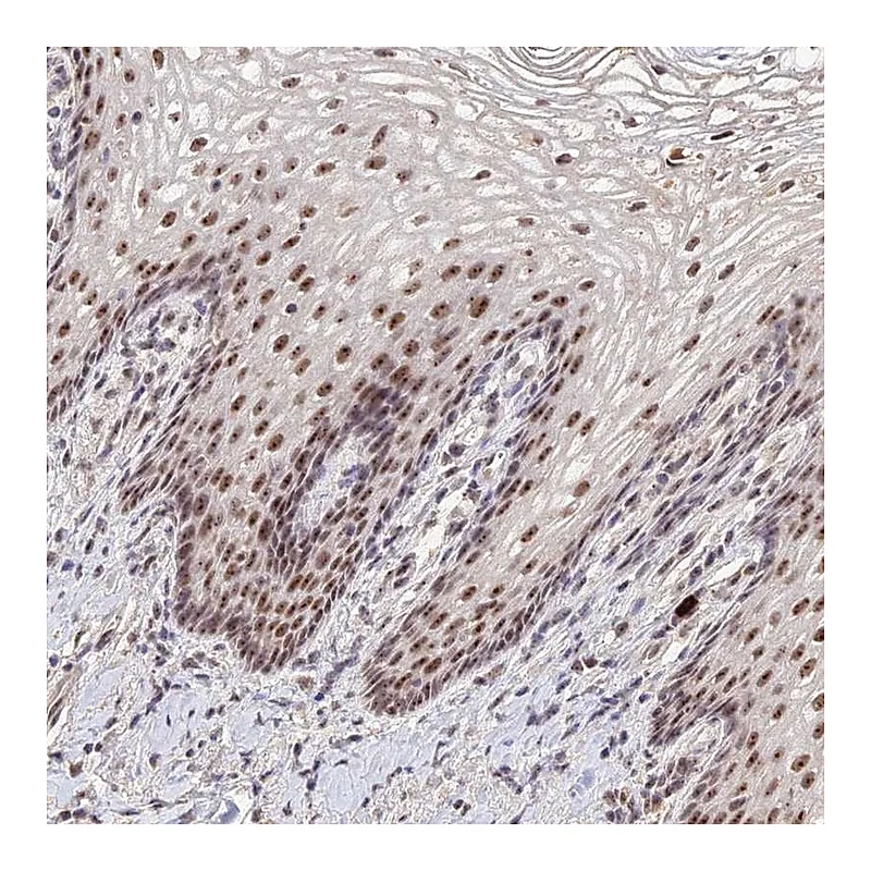 Atlas Antibodies Anti-CD3EAP Antibody