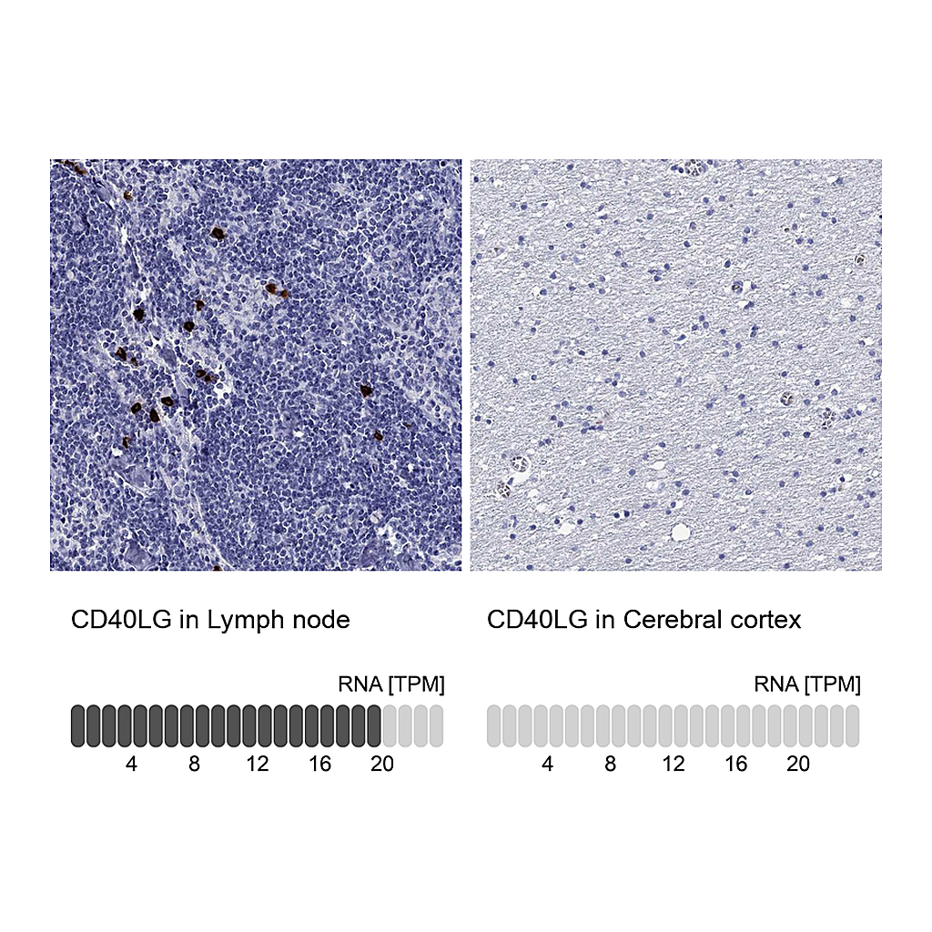 Atlas Antibodies Anti-CD40LG Antibody