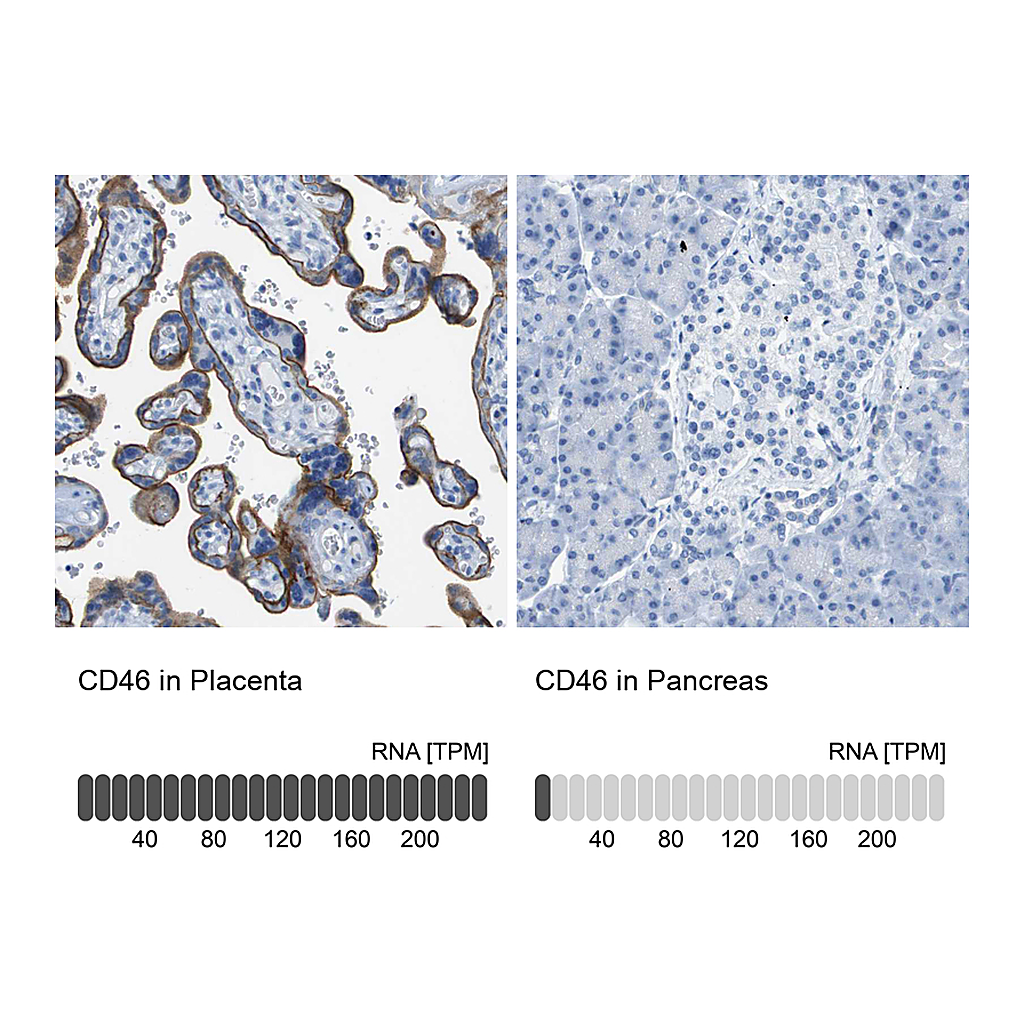Atlas Antibodies Anti-CD46 Antibody