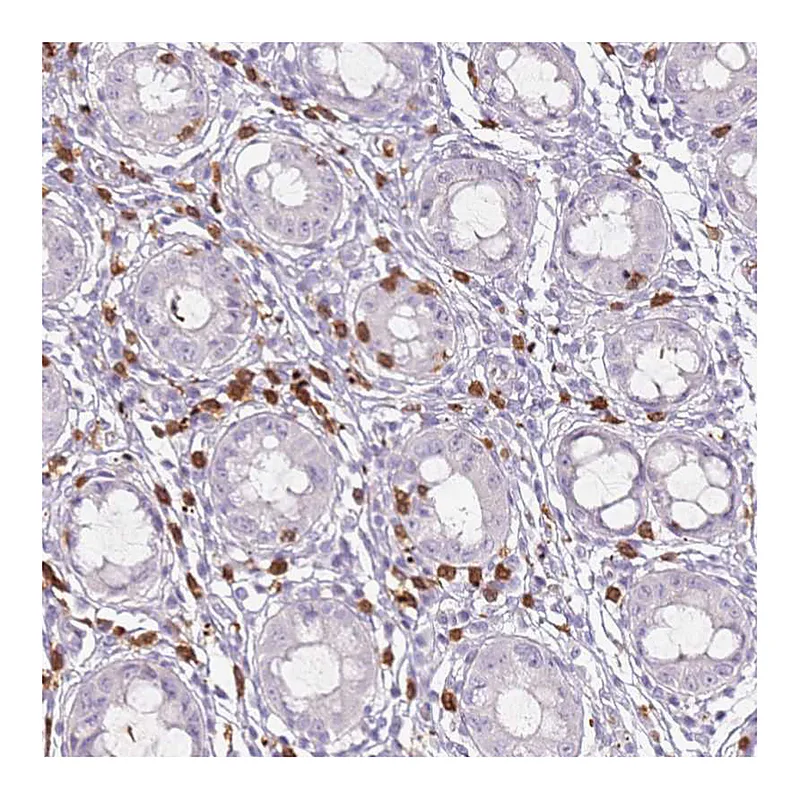 Atlas Antibodies Anti-CD40LG Antibody