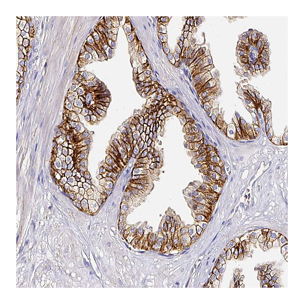 Atlas Antibodies Anti-CD47 Antibody