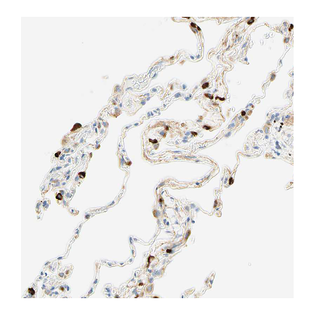 Atlas Antibodies Anti-CD63 Antibody