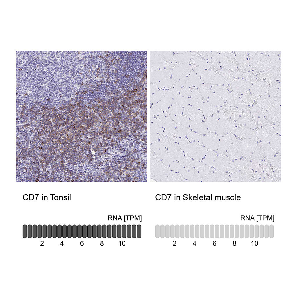 Atlas Antibodies Anti-CD7 Antibody