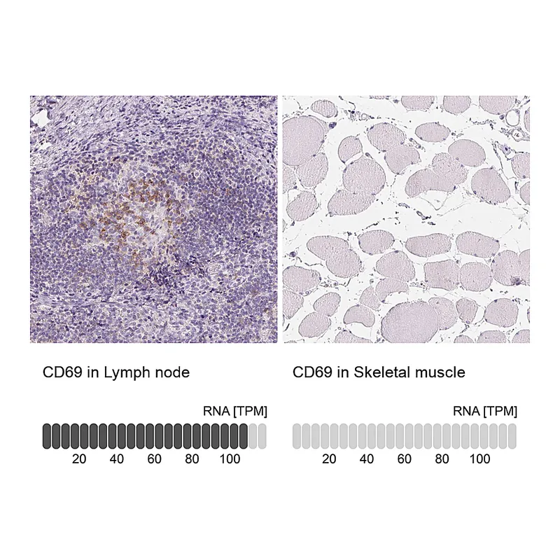 Atlas Antibodies Anti-CD69 Antibody