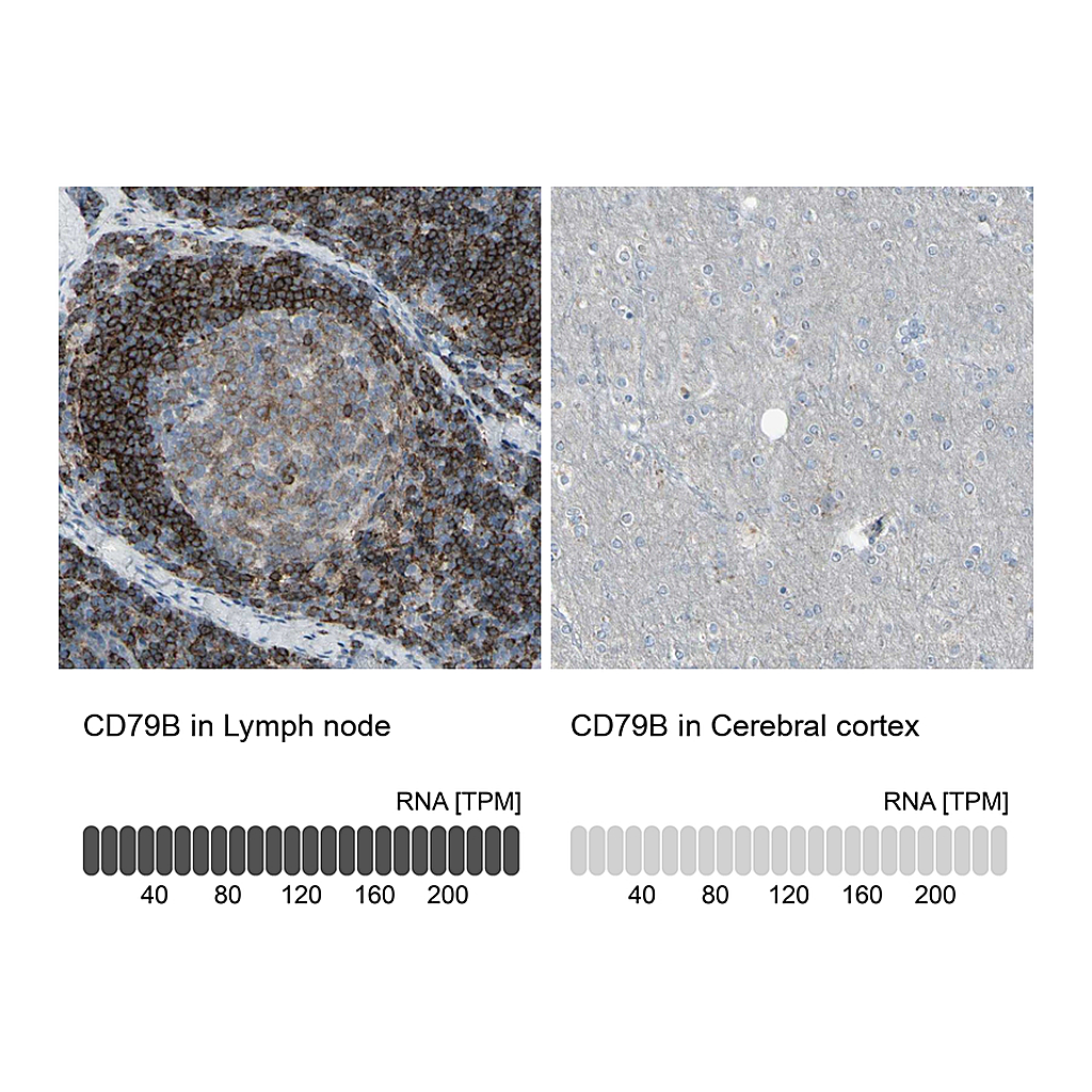 Atlas Antibodies Anti-CD79B Antibody