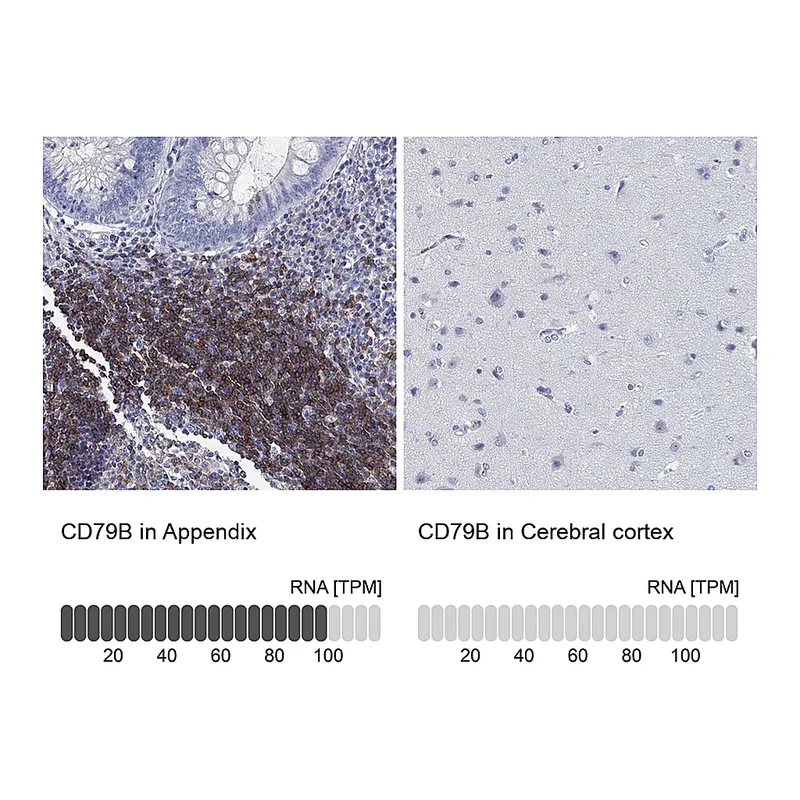 Atlas Antibodies Anti-CD79B Antibody