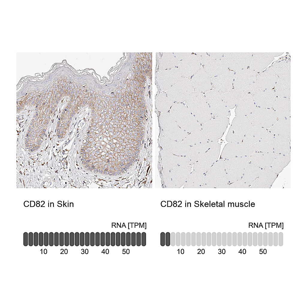 Atlas Antibodies Anti-CD82 Antibody