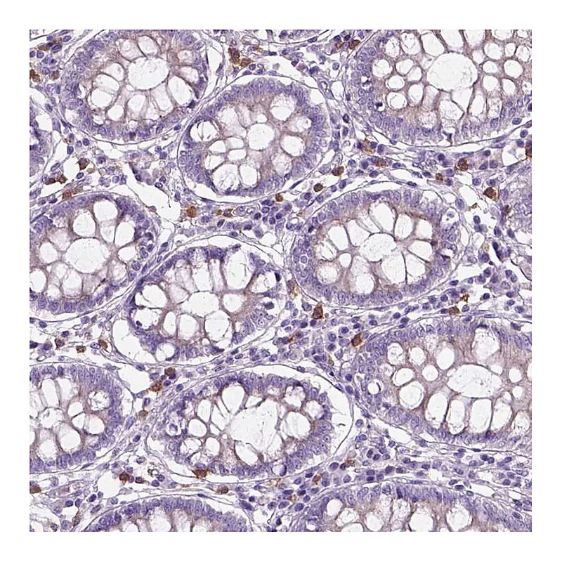 Atlas Antibodies Anti-CD84 Antibody