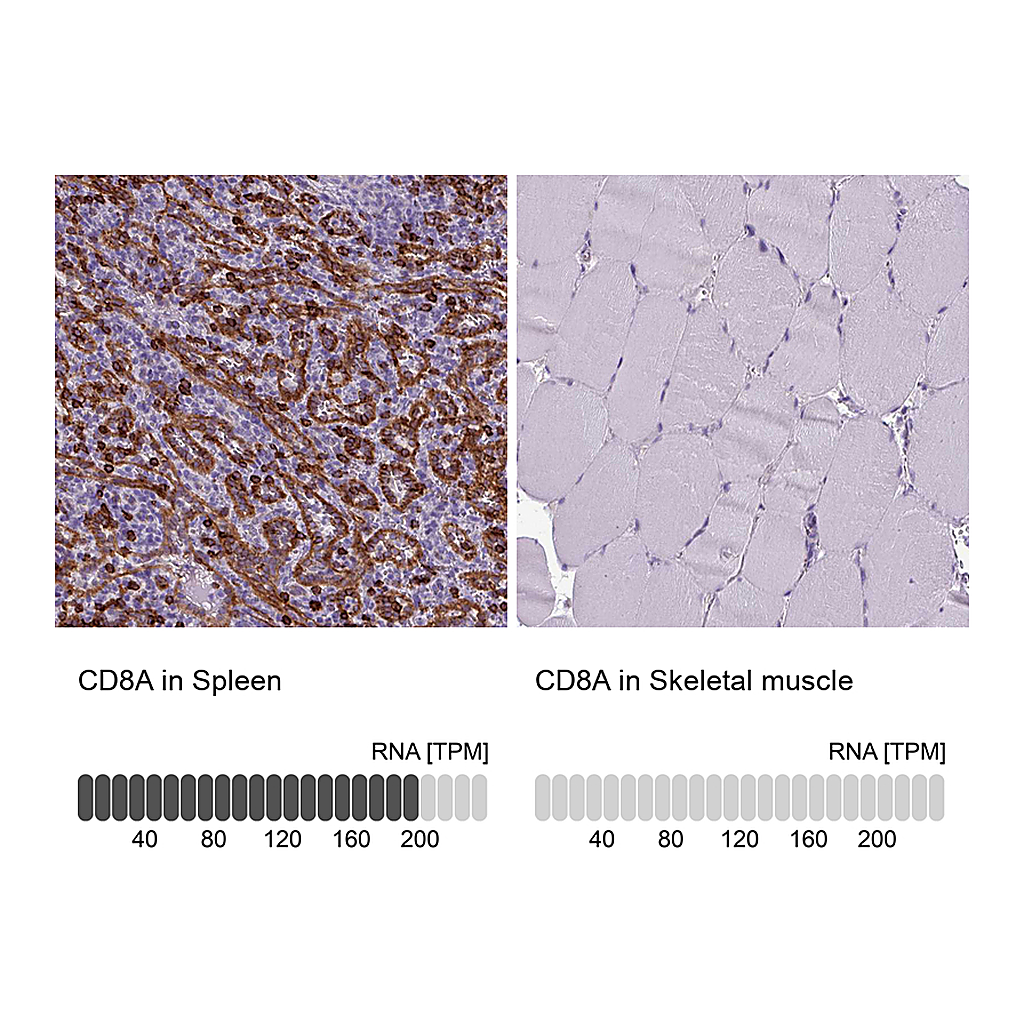 Atlas Antibodies Anti-CD8A Antibody