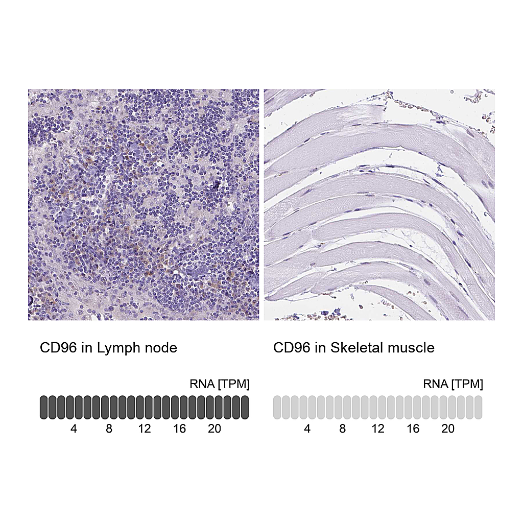 Atlas Antibodies Anti-CD96 Antibody