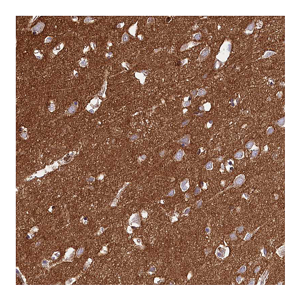 Atlas Antibodies Anti-CD99L2 Antibody