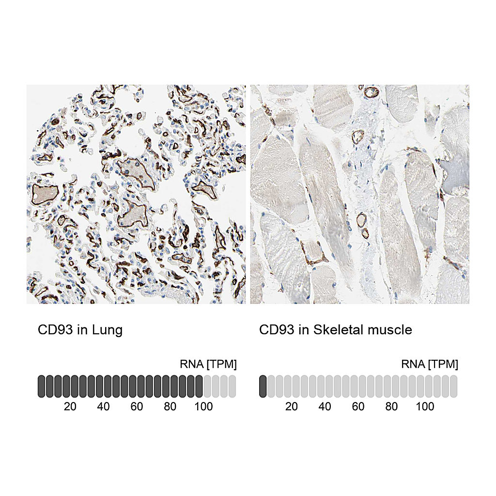 Atlas Antibodies Anti-CD93 Antibody