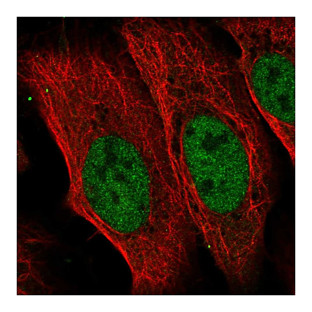 Atlas Antibodies Anti-CDADC1 Antibody