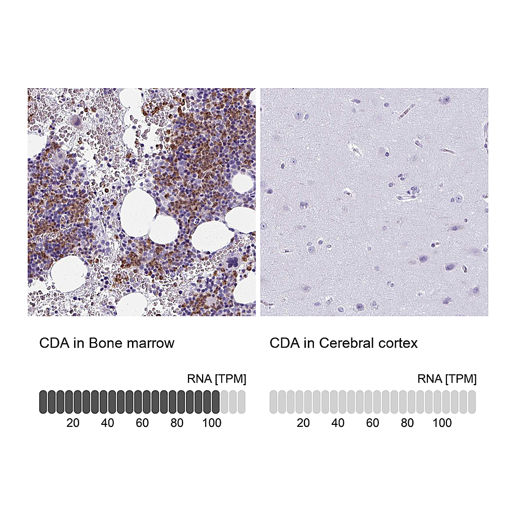 Atlas Antibodies Anti-CDA Antibody