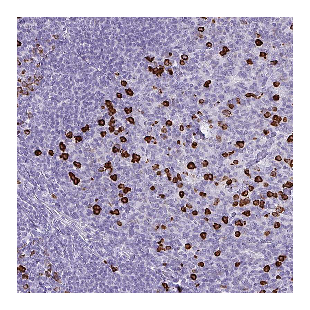 Atlas Antibodies Anti-CDADC1 Antibody