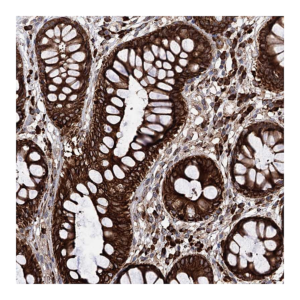 Atlas Antibodies Anti-CDAN1 Antibody