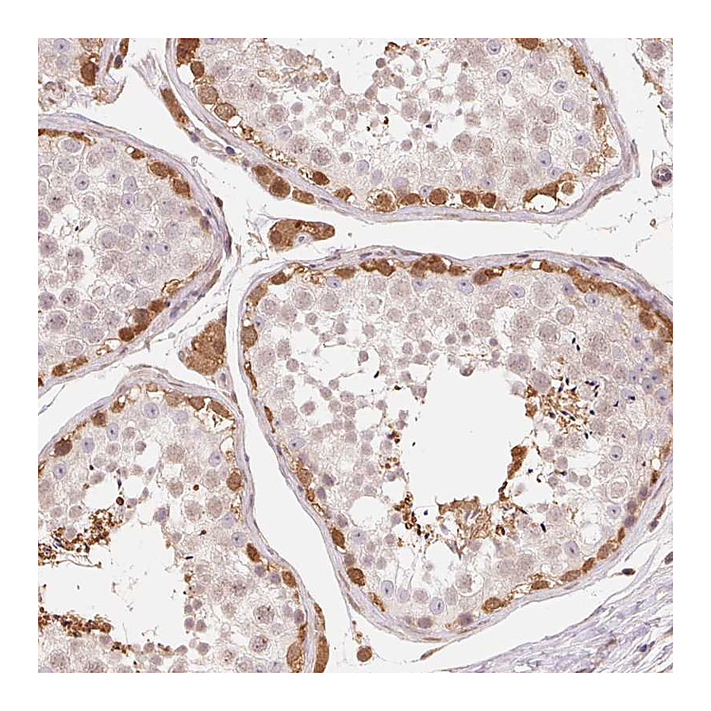 Atlas Antibodies Anti-CDC123 Antibody